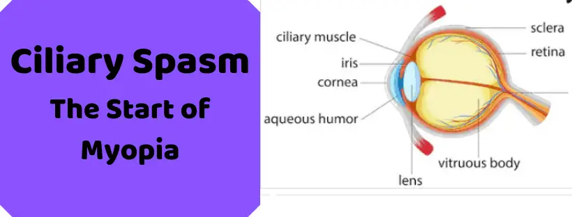 Ciliary Spasm